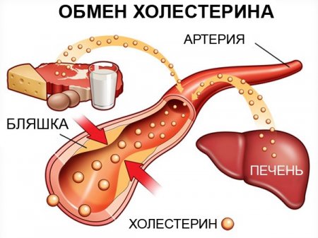 Как снизить уровень холестерина в крови.